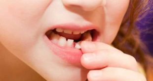 تعبیر خواب افتادن دندان نیش - افتادن دندان شیری و دندان آسیاب در خواب چه تعبیری دارد